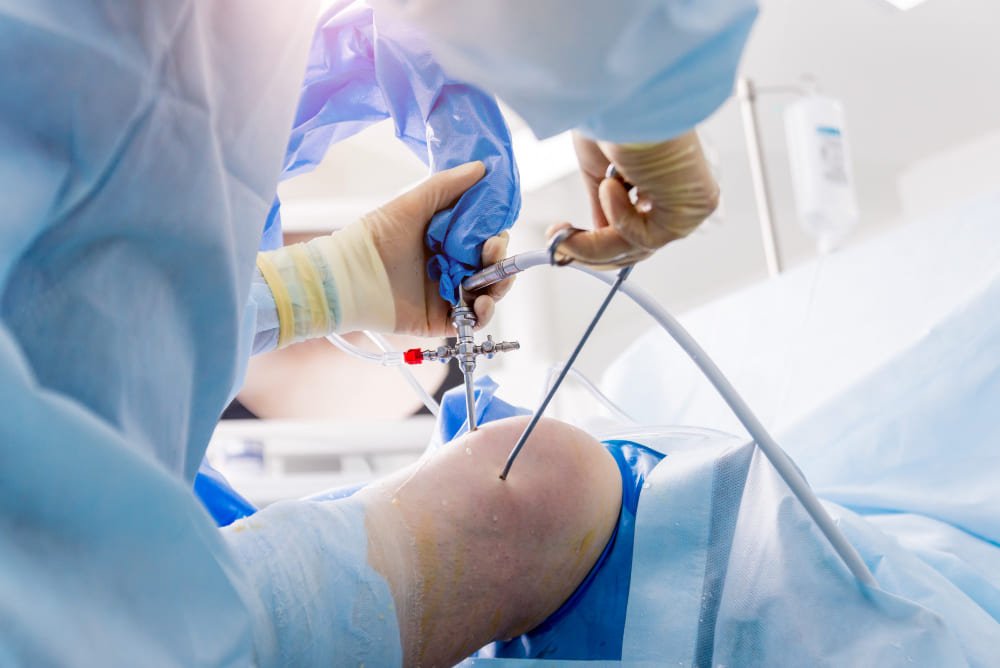 Artroscopia en Naucalpan: Diagnóstico y tratamiento preciso de lesiones articulares